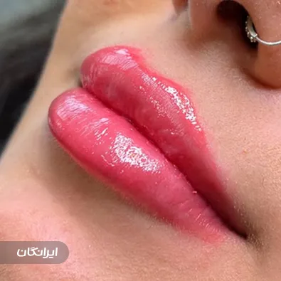 کلینیک زیبایی و لیزر نسیم قیطریه