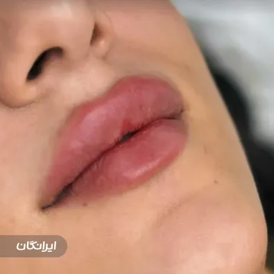 کلینیک زیبایی ونوس ظفر