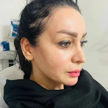کلینیک زیبایی ماهورا
