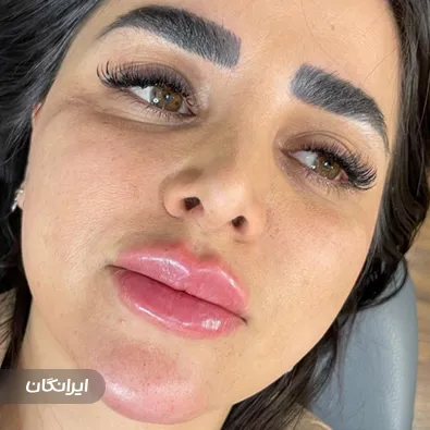 کلینیک زیبایی رامیلا