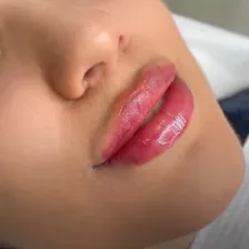کلینیک زیبایی شایلین