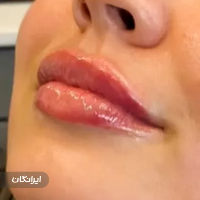 کلینیک زیبایی مه نگار