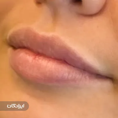 کلینیک زیبایی مه نگار