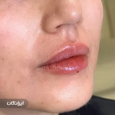 کلینیک زیبایی دکتر ریحانه احمدخانی