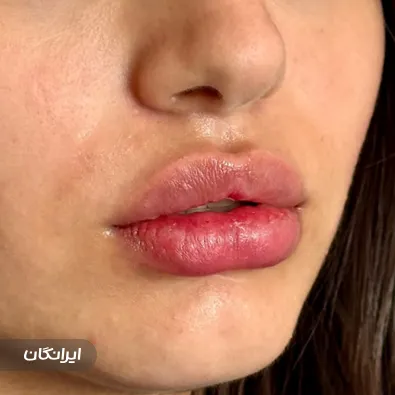 کلینیک زیبایی دکتر ریحانه احمدخانی