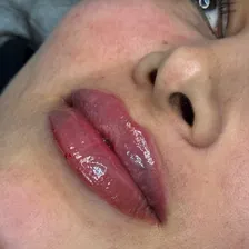 کلینیک زیبایی الین