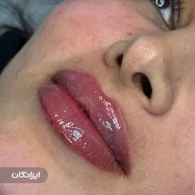 کلینیک زیبایی الین