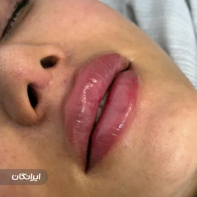 کلینیک زیبایی الین