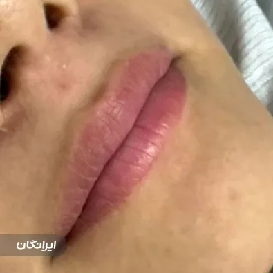 کلینیک زیبایی الین