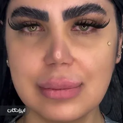 کلینیک زیبایی سلین