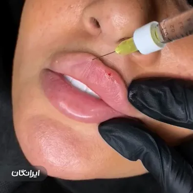 کلینیک زیبایی سلین