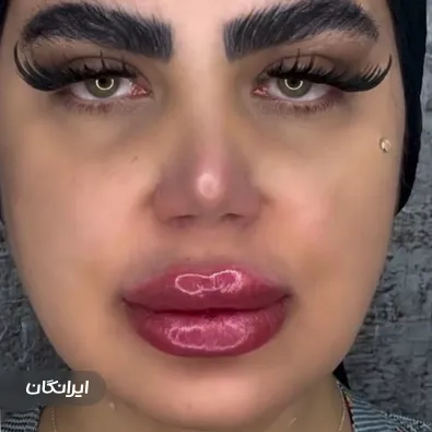 کلینیک زیبایی سلین