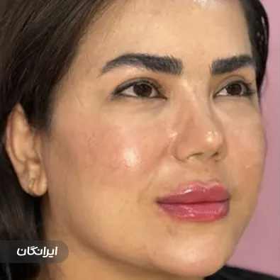 کلینیک زیبایی دکتر مرضیه فرقانی