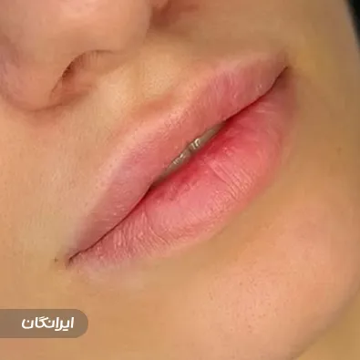 کلینیک زیبایی مایا