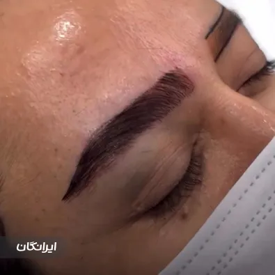 کلینیک زیبایی راشا