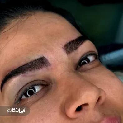 کلینیک زیبایی راشا