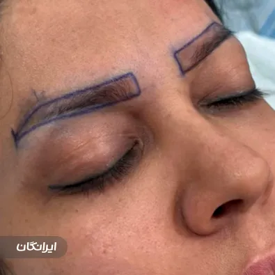 کلینیک زیبایی راشا