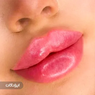 کلینیک زیبایی دکتر لیلی شاه حسینی