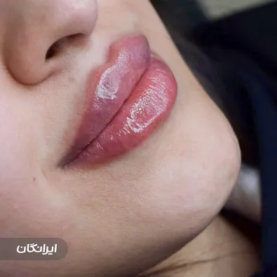 کلینیک زیبایی دکتر لیلی شاه حسینی