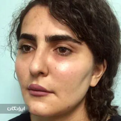 کلینیک زیبایی بهشاد