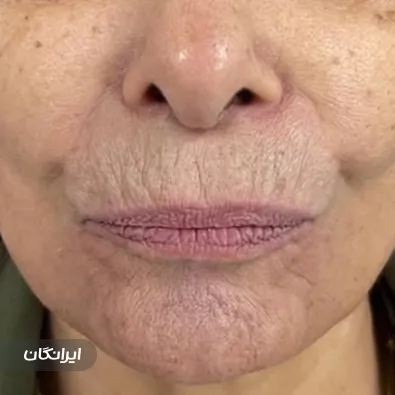 کلینیک زیبایی نورسیما