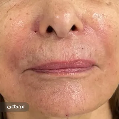 کلینیک زیبایی نورسیما