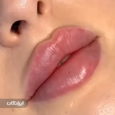 کلینیک زیبایی آورین