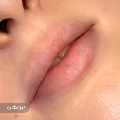 کلینیک زیبایی آورین