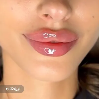 کلینیک زیبایی آورین