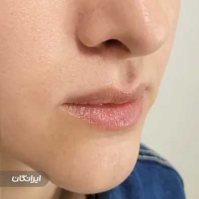 کلینیک زیبایی نیکا