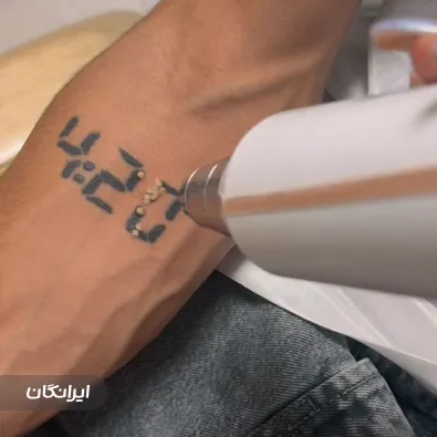 کلینیک زیبایی ماه تهران