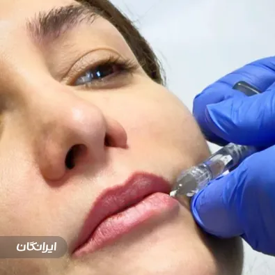 دکتر محمد شیزرپور