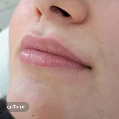 کلینیک زیبایی مهتاب