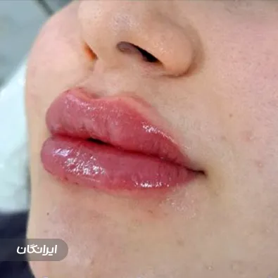 کلینیک زیبایی مهتاب