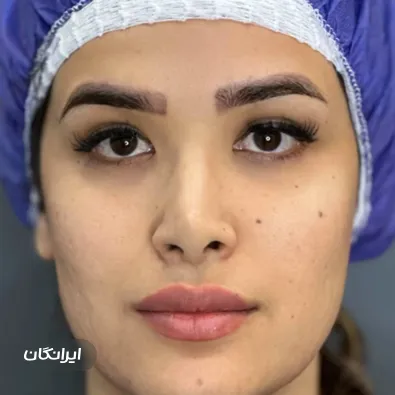 کلینیک زیبایی بیوتی سنتر