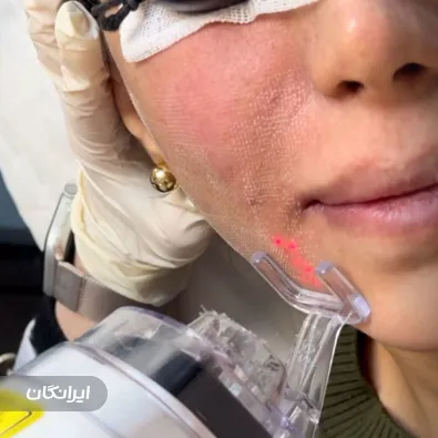 کلینیک زیبایی دکتر بنفشه علایی