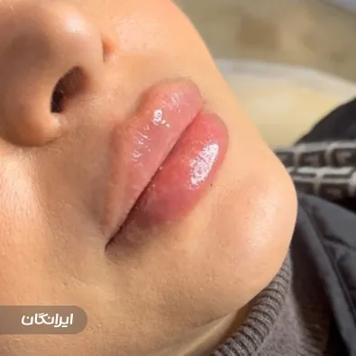 کلینیک زیبایی نیستا