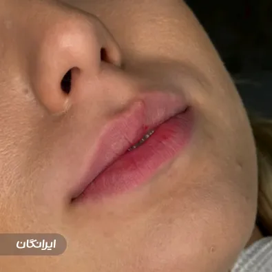 کلینیک زیبایی نیستا