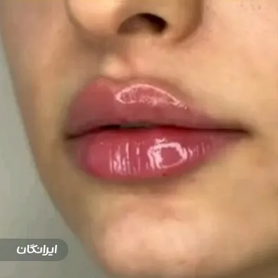 کلینیک زیبایی لیانا