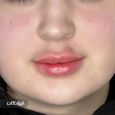 کلینیک زیبایی مهرافروز