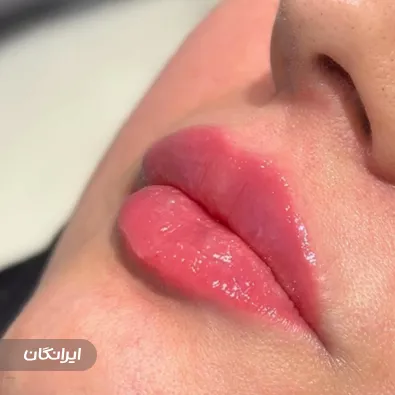 کلینیک زیبایی مهرافروز