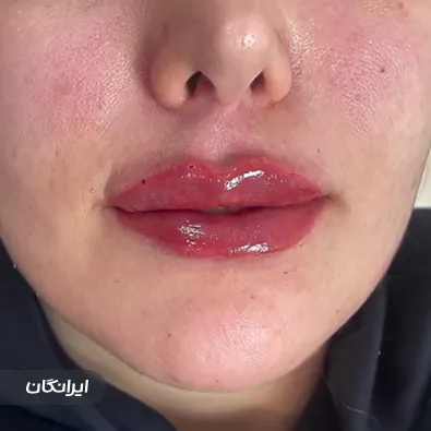 کلینیک زیبایی ماه شینا