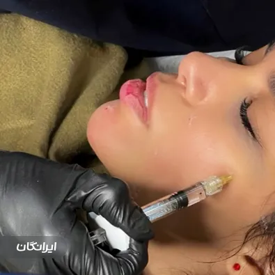 کلینیک زیبایی لوسین