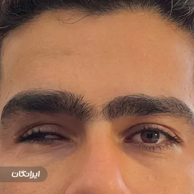 ارتوپدی فنی نگاه توس