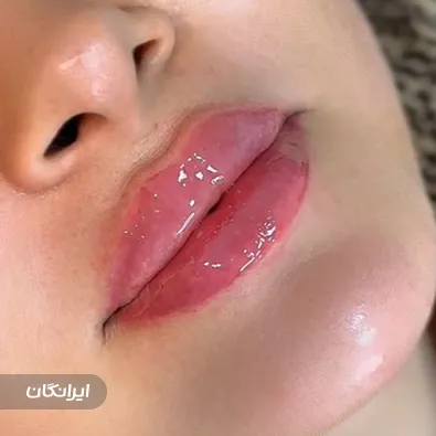 کلینیک زیبایی دکتر امیرحسین دینی