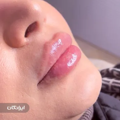 کلینیک زیبایی لیزر سنتر