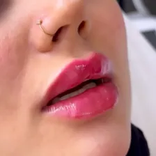 کلینیک زیبایی لیزر سنتر