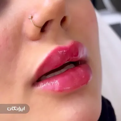 کلینیک زیبایی لیزر سنتر