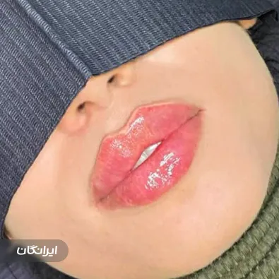 مرکز پوست و مو شمیران سنتر