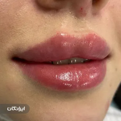 مرکز پوست و مو شمیران سنتر